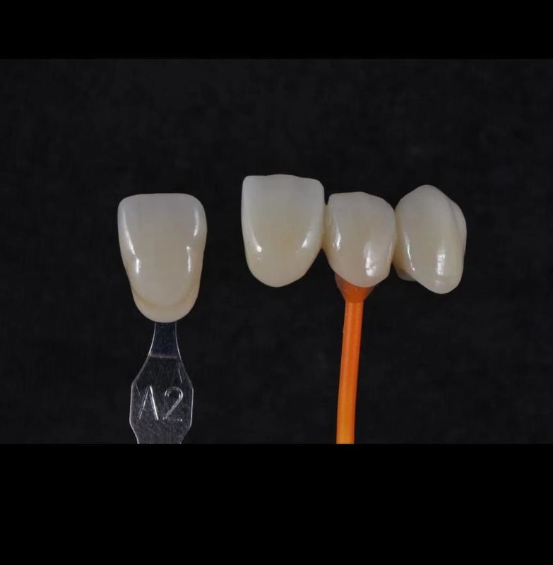 3D Pro Zirconia Dental Bianco CAD CAM Blocco 98/95/92mm Sistema aperto CE
