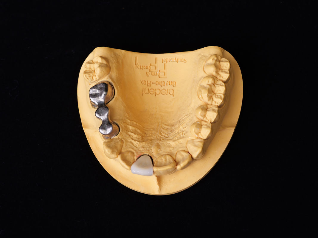 Audental 04 Lega Nobile Argento-Palladio Legatura di Porcellana Bianca Pd53.3% Per Restaurazioni Dentali Di Lunga Durata