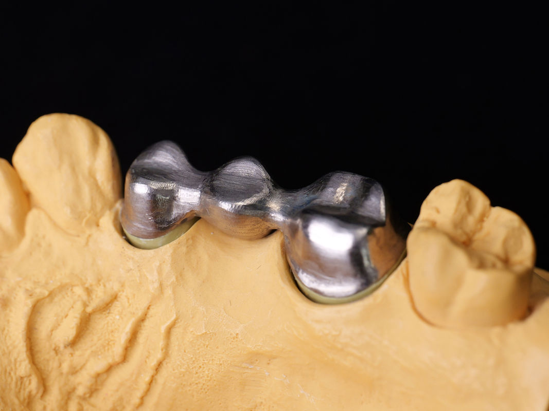 Audental 04 Lega Nobile Argento-Palladio Legatura di Porcellana Bianca Pd53.3% Per Restaurazioni Dentali Di Lunga Durata