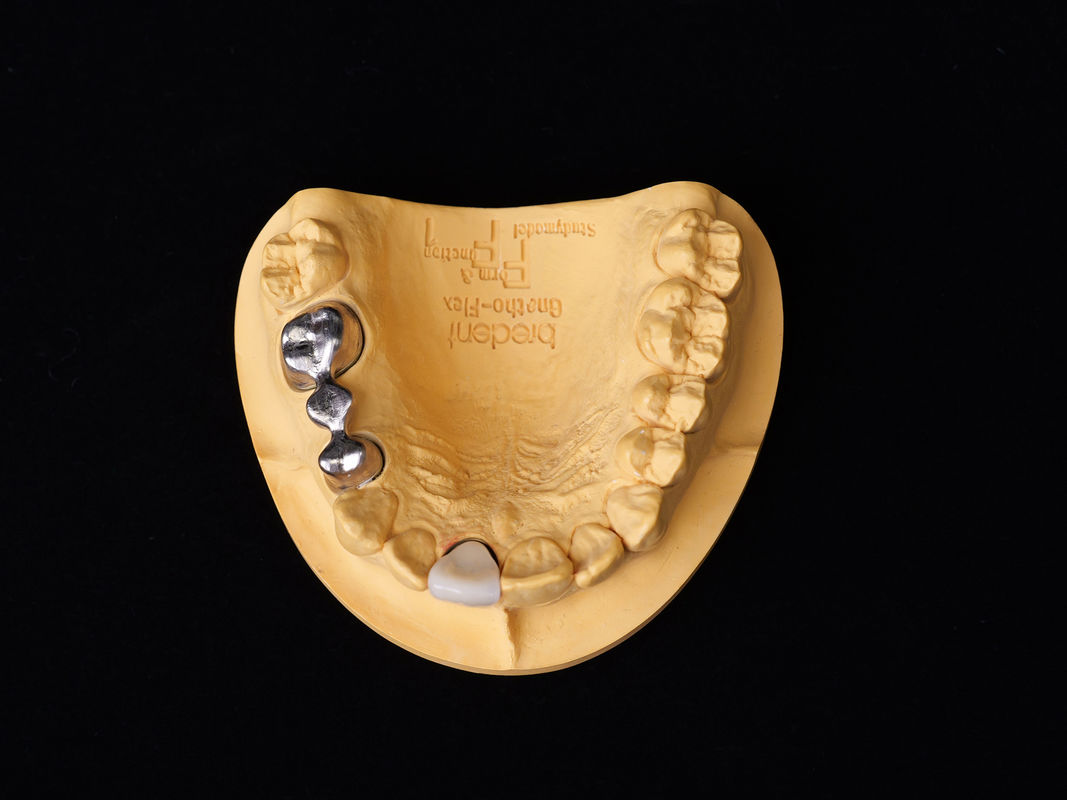 Audental 43 Legatura di porcellana argento-palladio Legatura bianca Pd43% Legatura nobile per restauri dentali forti ed estetici