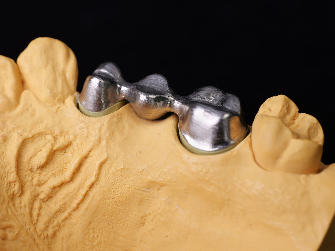 Audental 43 Legatura di porcellana argento-palladio Legatura bianca Pd43% Legatura nobile per restauri dentali forti ed estetici
