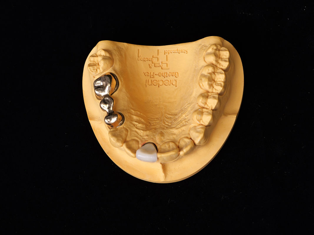 Audental 90 Restaurazioni dentali Alta lega nobile, Lega ceramica dentale giallo Au89.5%