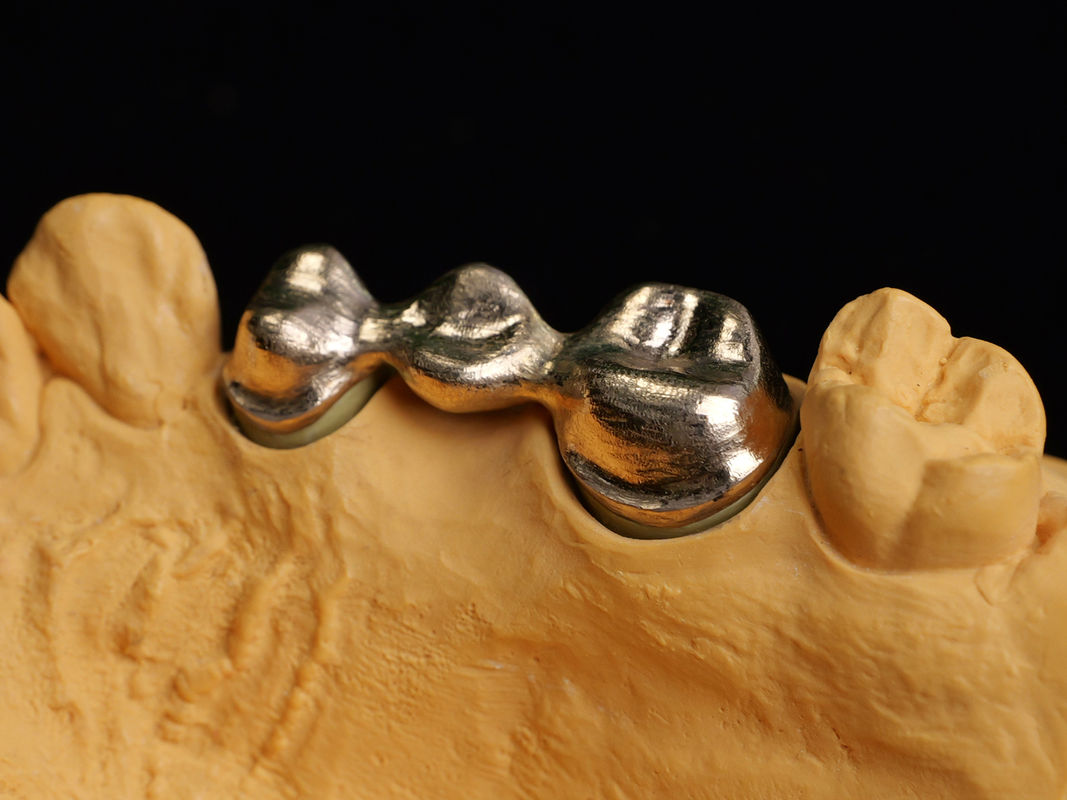 Audental 90 Restaurazioni dentali Alta lega nobile, Lega ceramica dentale giallo Au89.5%