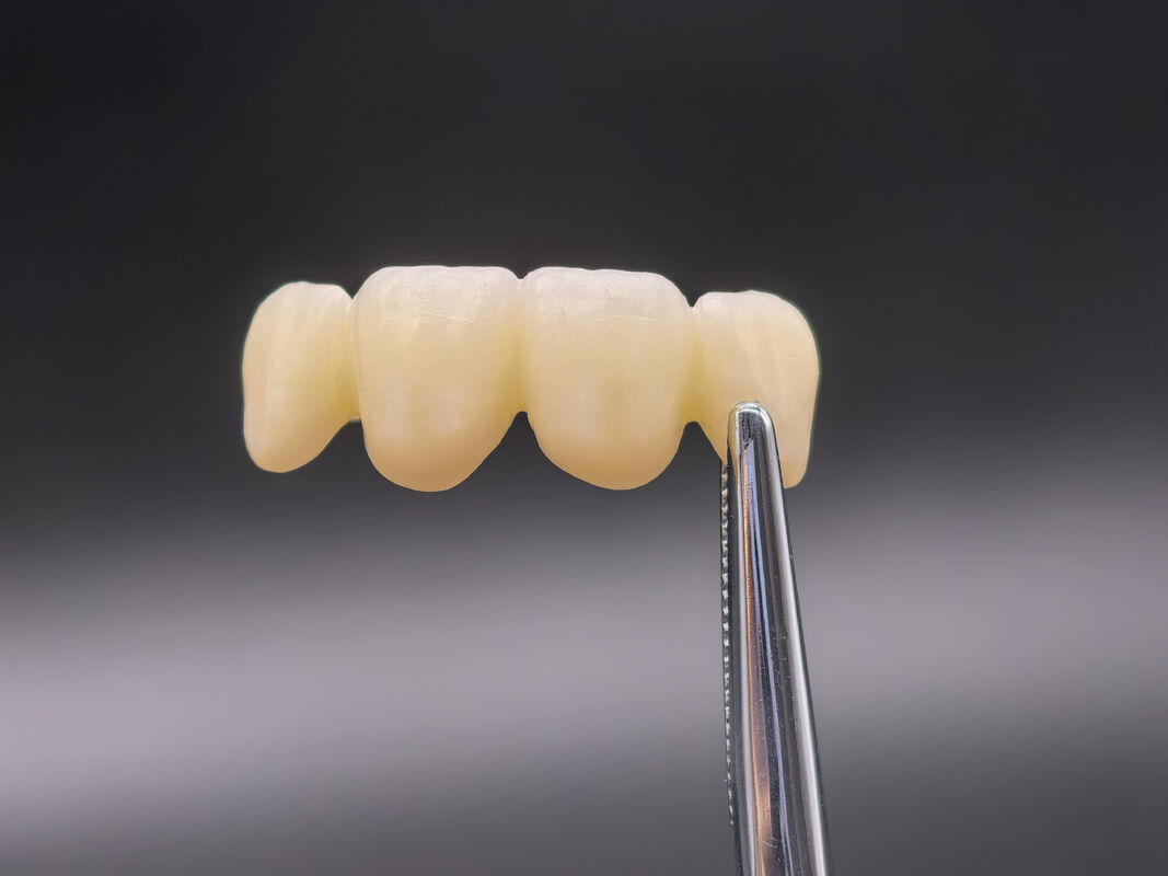 Blocco di zirconia dentale con transizioni d'ombra senza soluzione di continuità e alta densità per restauri dentali durevoli e realistici