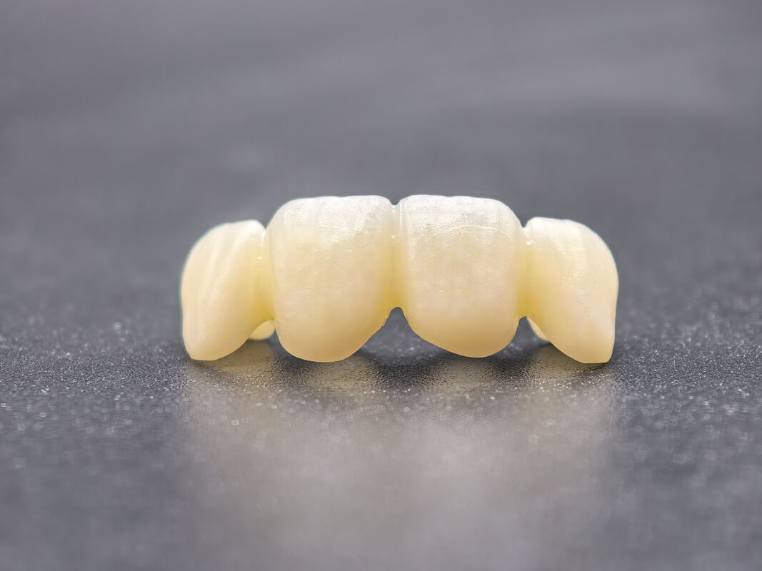 Blocco di zirconia dentale con transizioni d'ombra senza soluzione di continuità e alta densità per restauri dentali durevoli e realistici